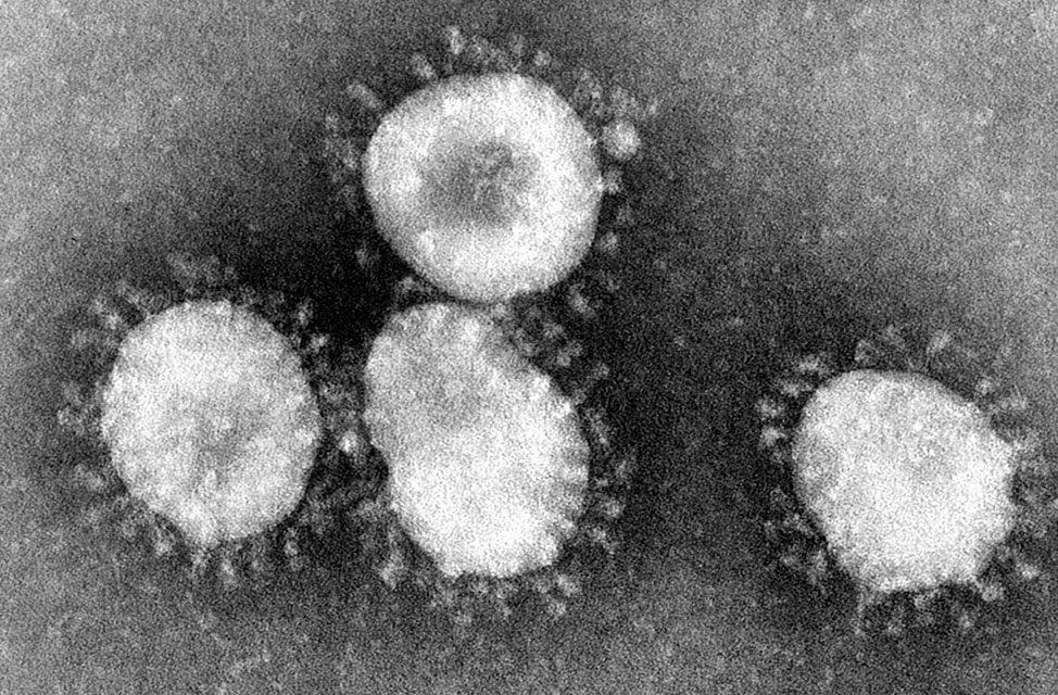 Koronavirus 2019-nCoV (Coronavirus)